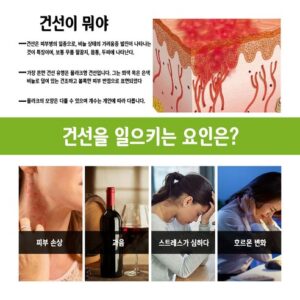 지금 준비해야하는 방송에 나온 베이포럽연고  바로 이것입니다. 패키지